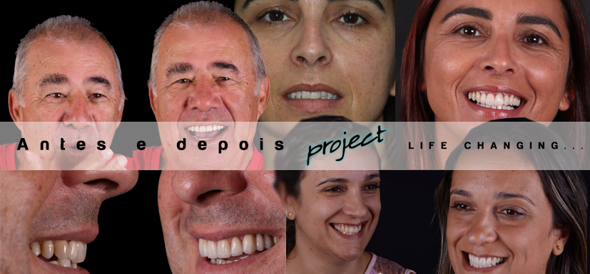Projectos de estética dentária
